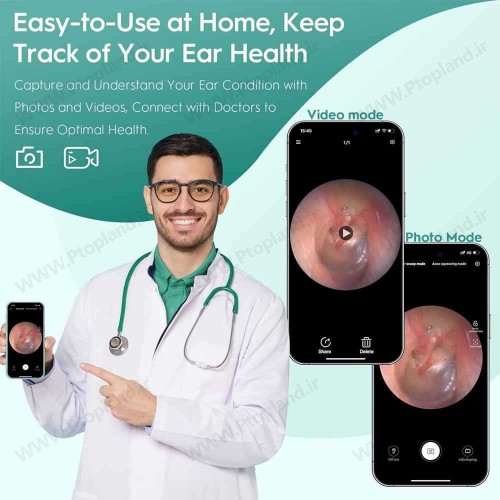 گوش پاک‌کن هوشمند Oxbird با دوربین 1080P و اتصال وایرلس