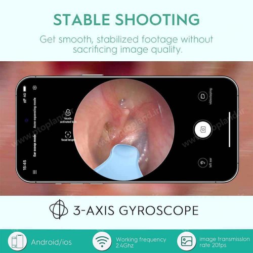 گوش پاک‌کن هوشمند Oxbird با دوربین 1080P و اتصال وایرلس