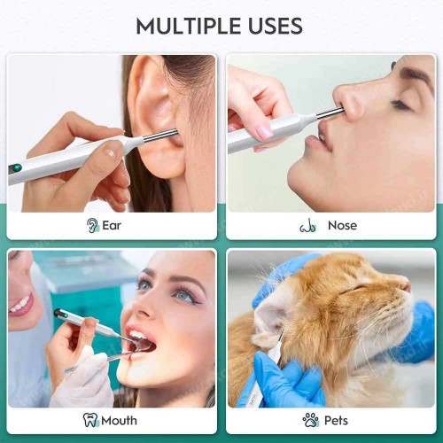 گوش پاک‌کن هوشمند Oxbird با دوربین 1080P و اتصال وایرلس